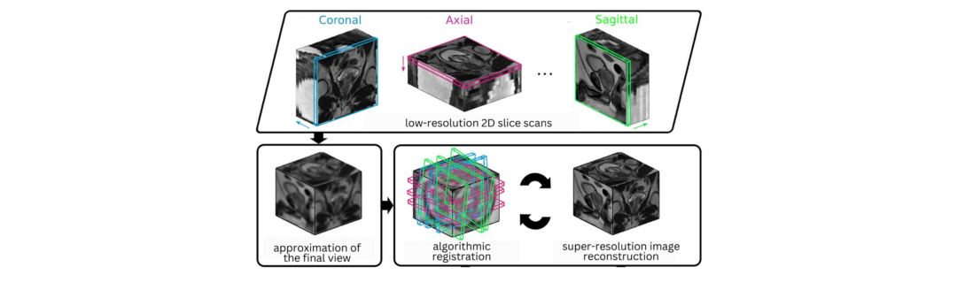 Image generation using GenAI for enhancing visual quality of radiology scans